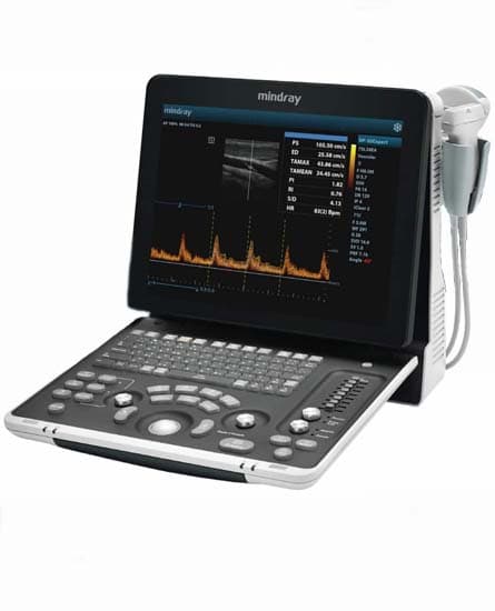 Mindray DP-50 Expert